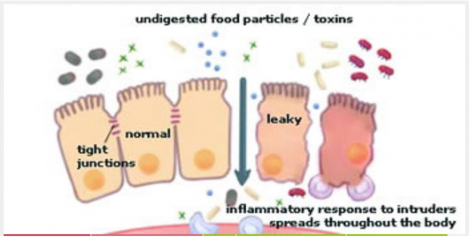 Leaky Gut